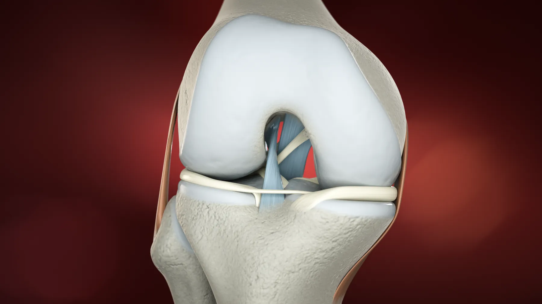Tendoplus ACL Therapy — image 3